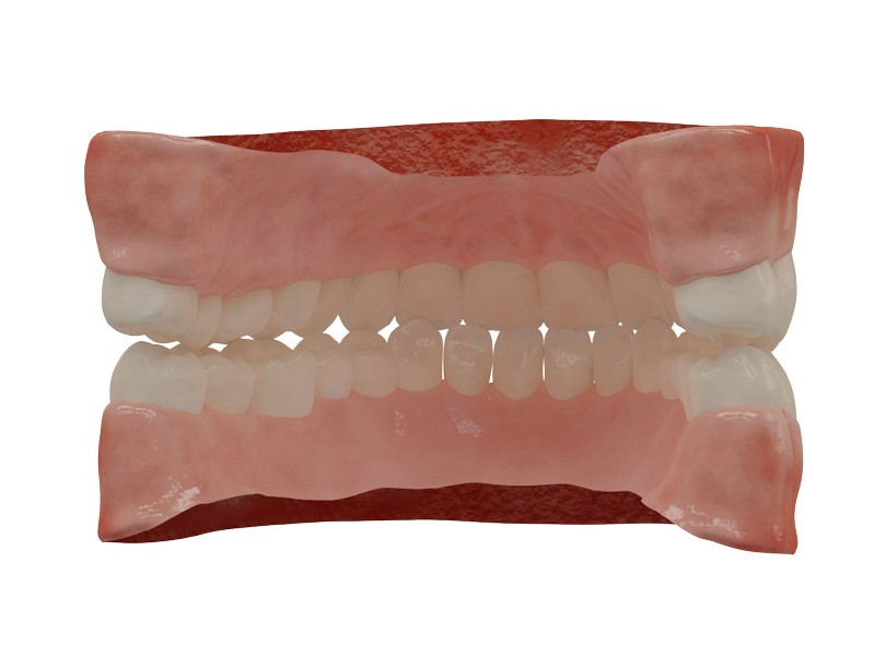 Human Teeth preview image 2